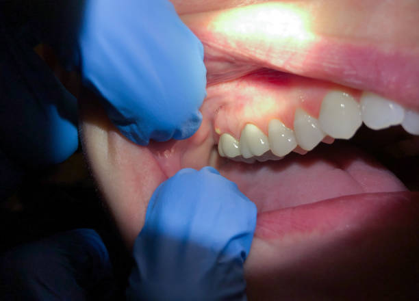 Best Pediatric Emergency Dentist in Wewa, OK