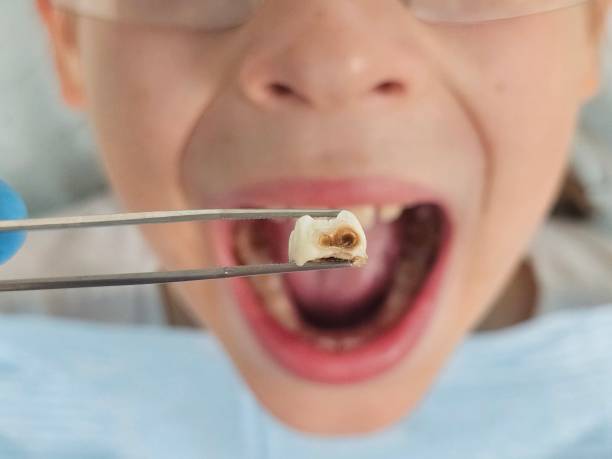 Best Same-Day Emergency Dentist in Wewa, OK