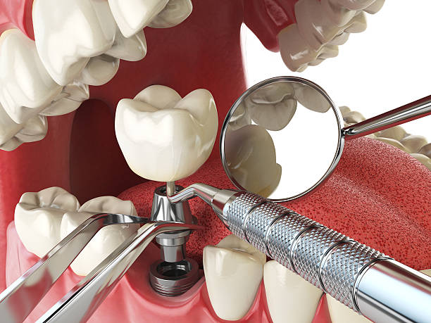 Best After-Hours Emergency Dentist in Wewa, OK